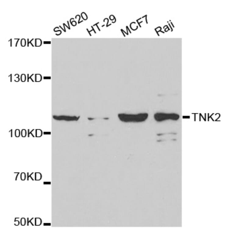 Western blot - TNK2 Antibody from Signalway Antibody (32692) - Antibodies.com