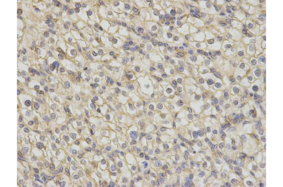 Immunohistochemistry - TNK2 Antibody from Signalway Antibody (32692) - Antibodies.com