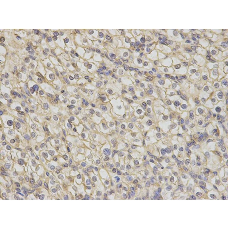 Immunohistochemistry - TNK2 Antibody from Signalway Antibody (32692) - Antibodies.com