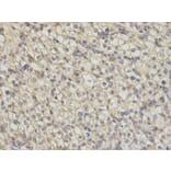 Immunohistochemistry - TNK2 Antibody from Signalway Antibody (32692) - Antibodies.com