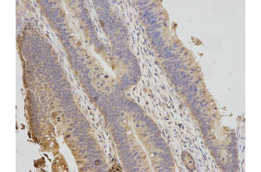 Immunohistochemistry - TNK2 Antibody from Signalway Antibody (32692) - Antibodies.com