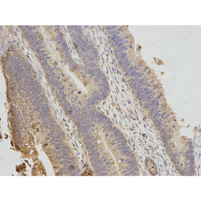 Immunohistochemistry - TNK2 Antibody from Signalway Antibody (32692) - Antibodies.com