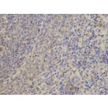 Immunohistochemistry - TNK2 Antibody from Signalway Antibody (32692) - Antibodies.com