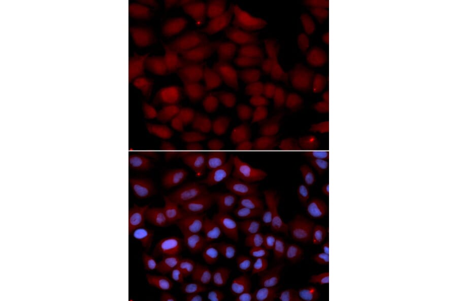 Immunofluorescence - TNK2 Antibody from Signalway Antibody (32692) - Antibodies.com