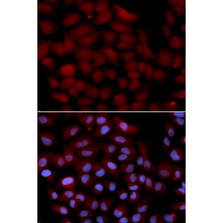 Immunofluorescence - TNK2 Antibody from Signalway Antibody (32692) - Antibodies.com