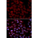 Immunofluorescence - TNK2 Antibody from Signalway Antibody (32692) - Antibodies.com