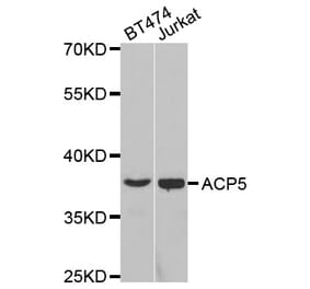 Western blot - ACP5 Antibody from Signalway Antibody (32694) - Antibodies.com