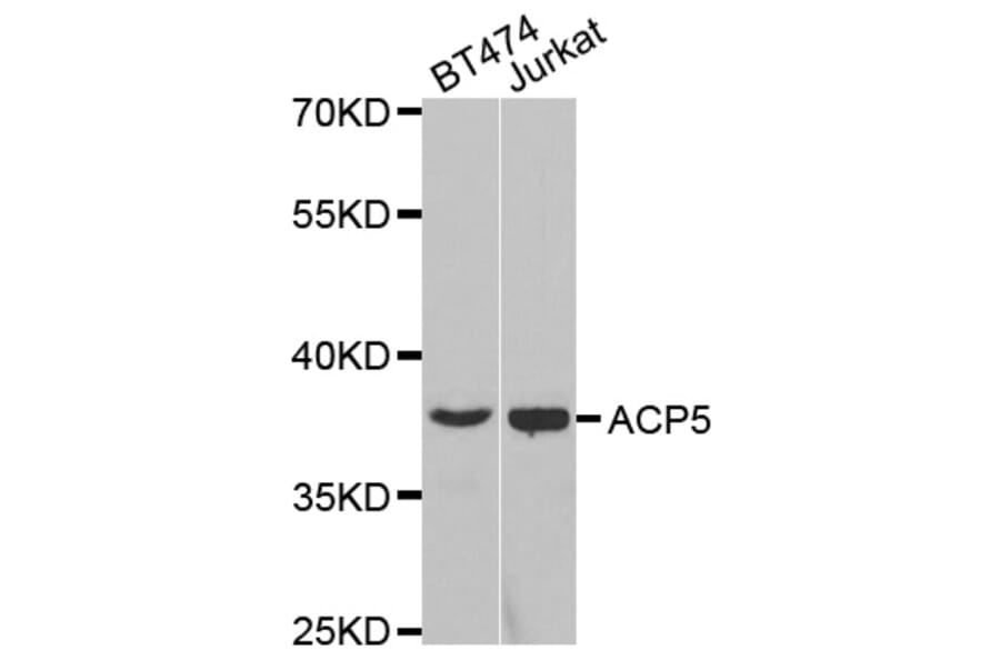 Western blot - ACP5 Antibody from Signalway Antibody (32694) - Antibodies.com