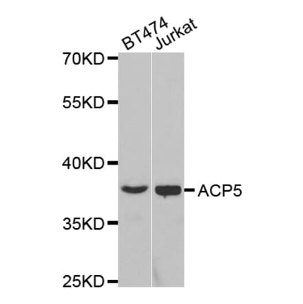 Western blot - ACP5 Antibody from Signalway Antibody (32694) - Antibodies.com