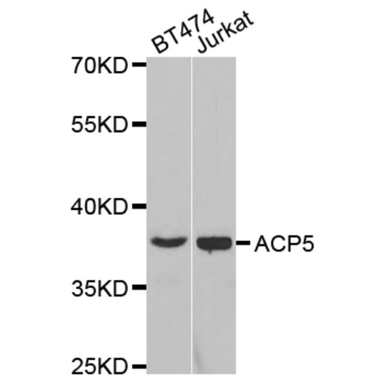 Western blot - ACP5 Antibody from Signalway Antibody (32694) - Antibodies.com
