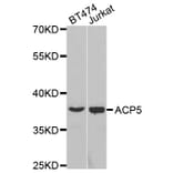Western blot - ACP5 Antibody from Signalway Antibody (32694) - Antibodies.com