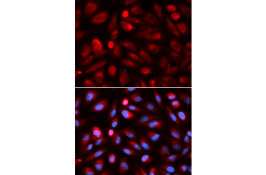 Immunofluorescence - ACP5 Antibody from Signalway Antibody (32694) - Antibodies.com