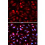 Immunofluorescence - ACP5 Antibody from Signalway Antibody (32694) - Antibodies.com