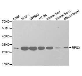 Western blot - RPS3 Antibody from Signalway Antibody (32698) - Antibodies.com