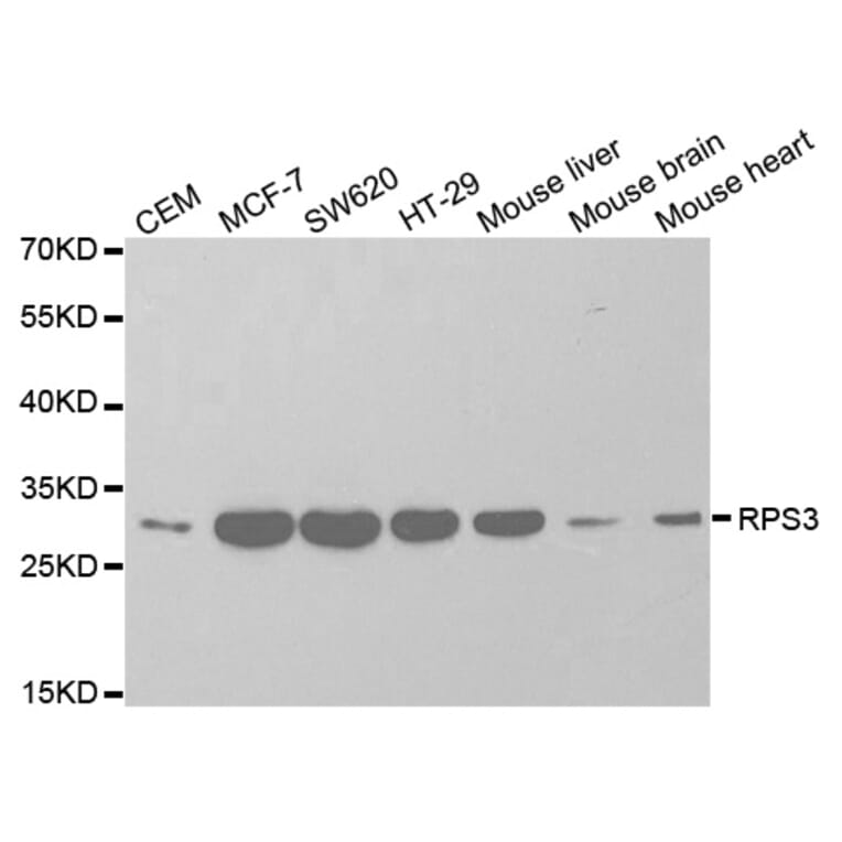 Western blot - RPS3 Antibody from Signalway Antibody (32698) - Antibodies.com