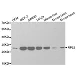 Western blot - RPS3 Antibody from Signalway Antibody (32698) - Antibodies.com