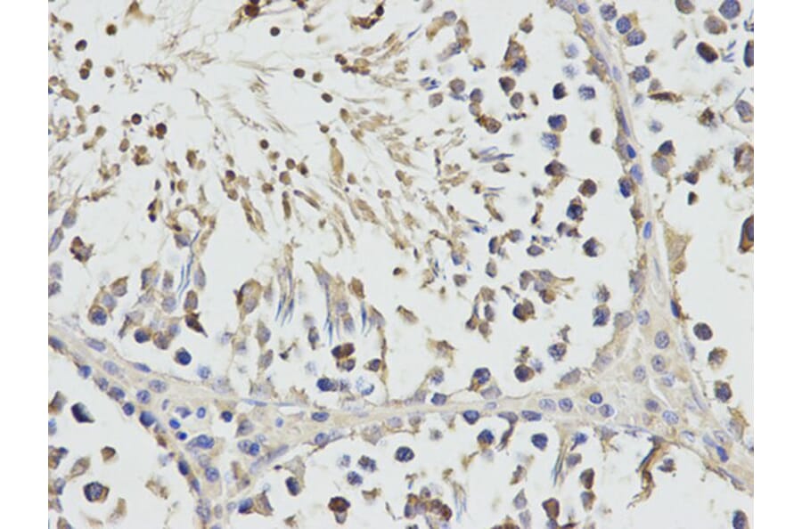 Immunohistochemistry - RPS3 Antibody from Signalway Antibody (32698) - Antibodies.com