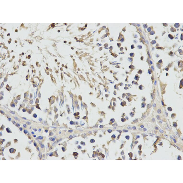 Immunohistochemistry - RPS3 Antibody from Signalway Antibody (32698) - Antibodies.com