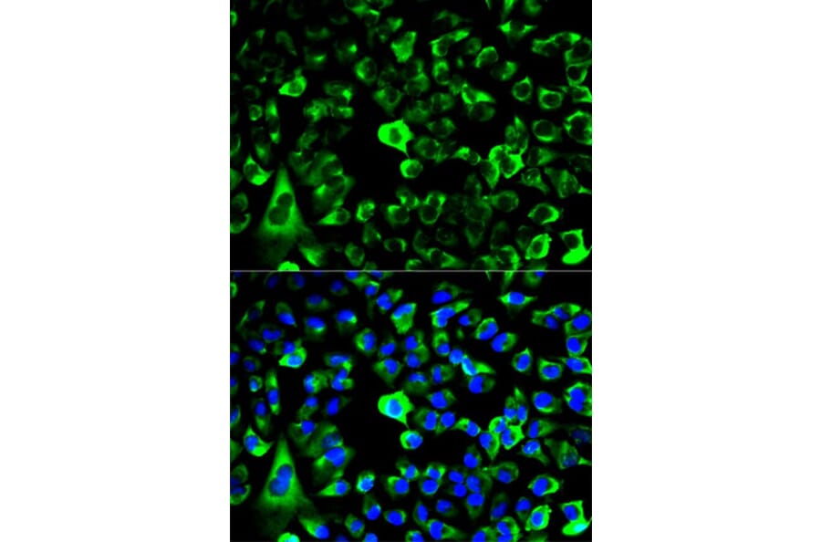 Immunofluorescence - RPS3 Antibody from Signalway Antibody (32698) - Antibodies.com