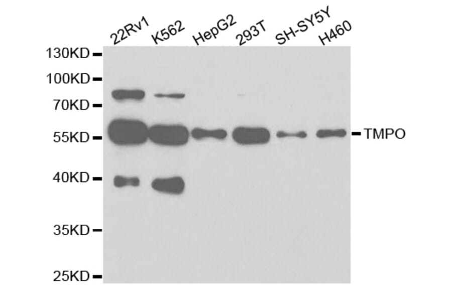 Western blot - TMPO Antibody from Signalway Antibody (32699) - Antibodies.com