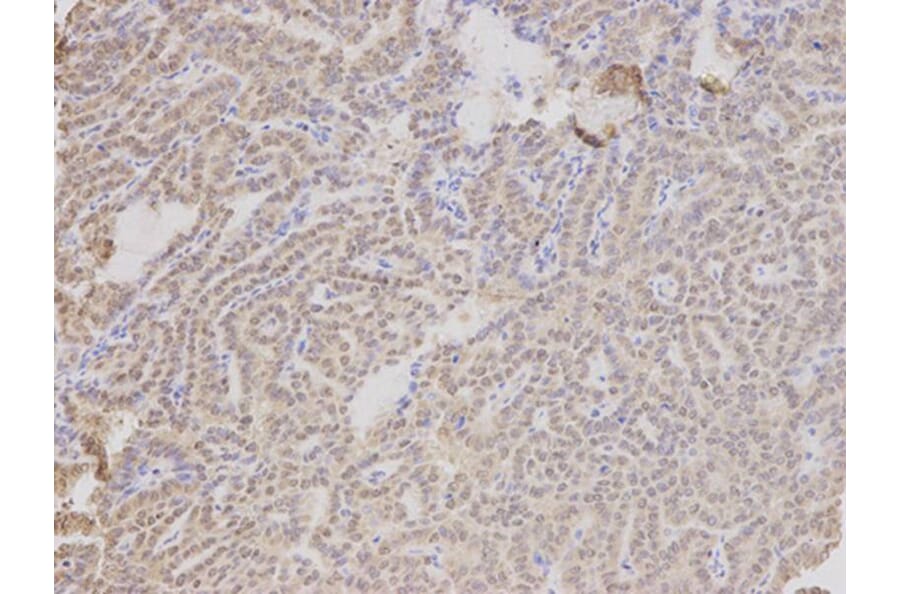 Immunohistochemistry - TMPO Antibody from Signalway Antibody (32699) - Antibodies.com