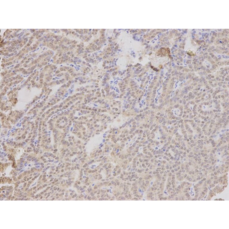 Immunohistochemistry - TMPO Antibody from Signalway Antibody (32699) - Antibodies.com