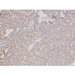 Immunohistochemistry - TMPO Antibody from Signalway Antibody (32699) - Antibodies.com