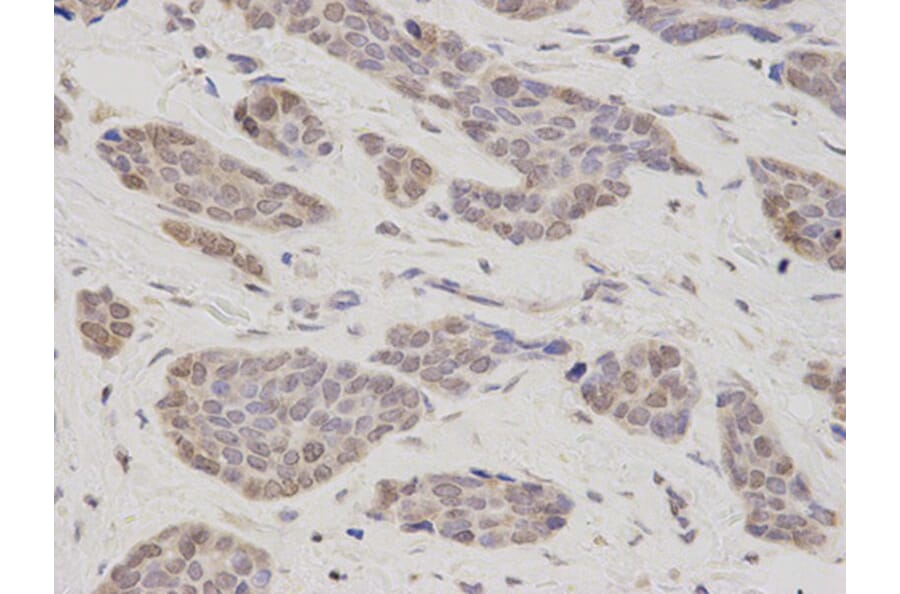 Immunohistochemistry - TMPO Antibody from Signalway Antibody (32699) - Antibodies.com
