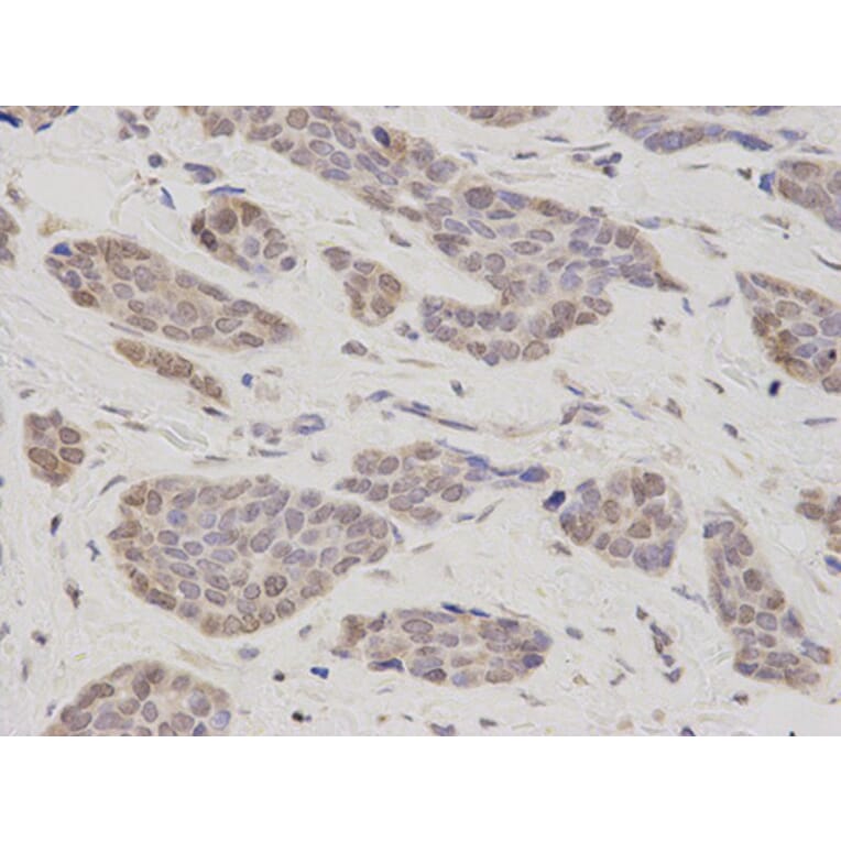 Immunohistochemistry - TMPO Antibody from Signalway Antibody (32699) - Antibodies.com