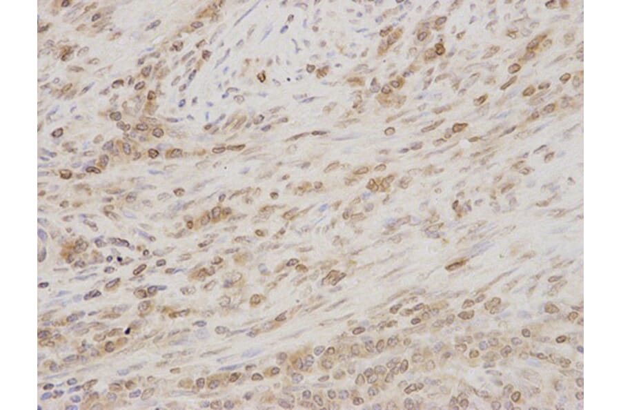 Immunohistochemistry - TMPO Antibody from Signalway Antibody (32699) - Antibodies.com