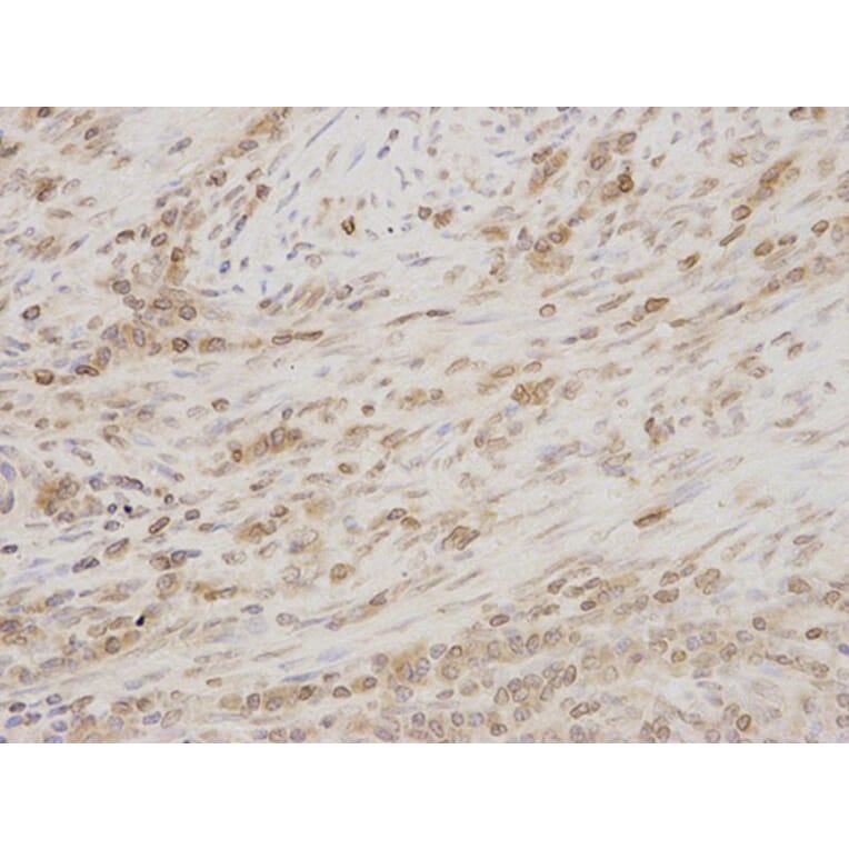 Immunohistochemistry - TMPO Antibody from Signalway Antibody (32699) - Antibodies.com