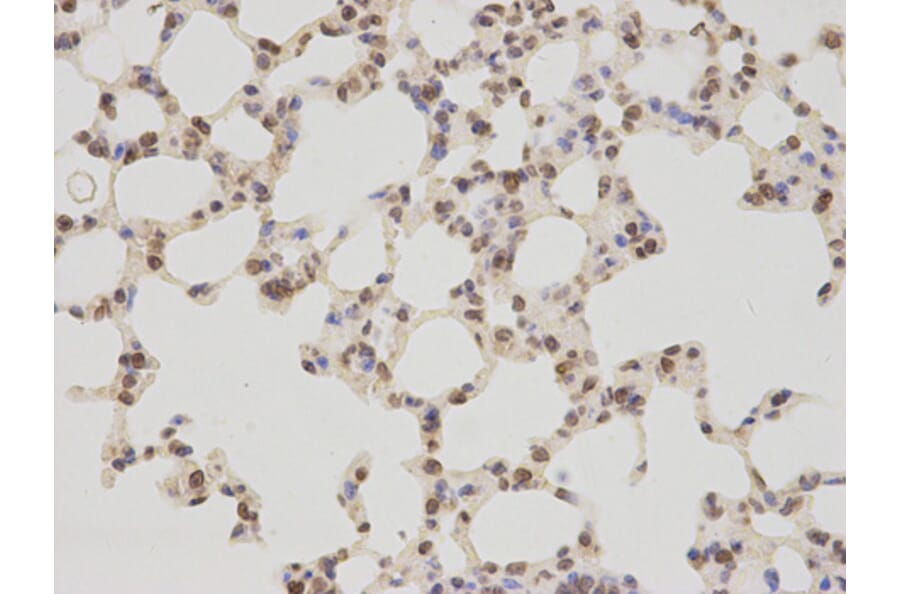 Immunohistochemistry - TMPO Antibody from Signalway Antibody (32699) - Antibodies.com