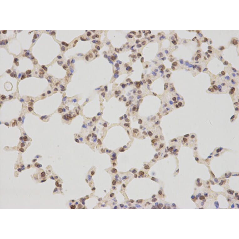 Immunohistochemistry - TMPO Antibody from Signalway Antibody (32699) - Antibodies.com