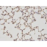 Immunohistochemistry - TMPO Antibody from Signalway Antibody (32699) - Antibodies.com