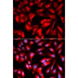 Immunofluorescence - HMMR Antibody from Signalway Antibody (32702) - Antibodies.com