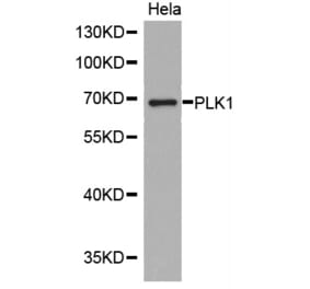 Western blot - PLK1 Antibody from Signalway Antibody (32706) - Antibodies.com