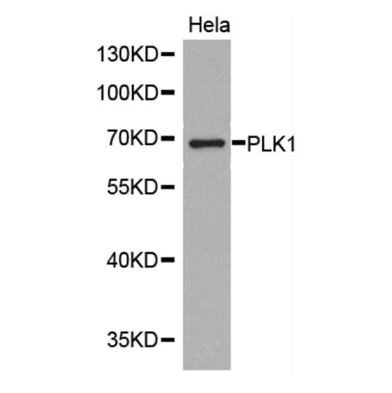 Western blot - PLK1 Antibody from Signalway Antibody (32706) - Antibodies.com