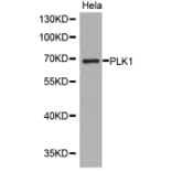 Western blot - PLK1 Antibody from Signalway Antibody (32706) - Antibodies.com