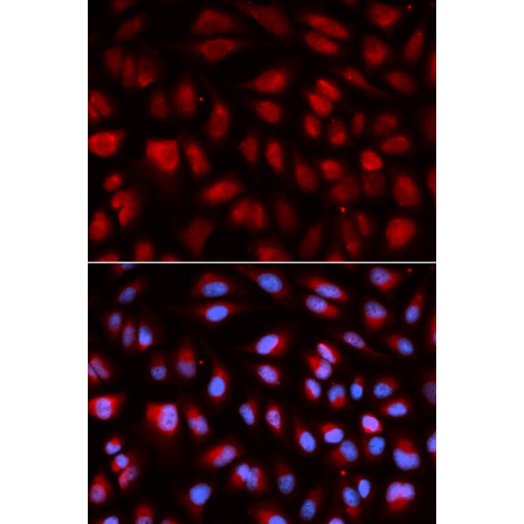 Immunofluorescence - PLK1 Antibody from Signalway Antibody (32706) - Antibodies.com