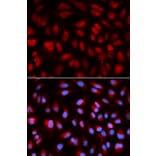 Immunofluorescence - PLK1 Antibody from Signalway Antibody (32706) - Antibodies.com