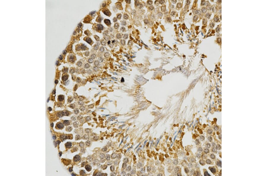 Immunohistochemistry - PLK1 Antibody from Signalway Antibody (32706) - Antibodies.com