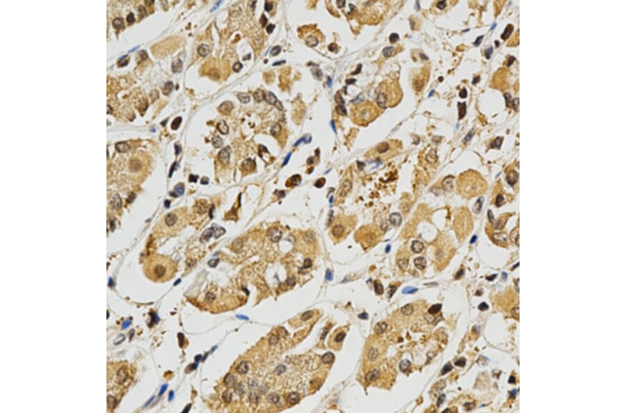 Immunohistochemistry - PLK1 Antibody from Signalway Antibody (32706) - Antibodies.com