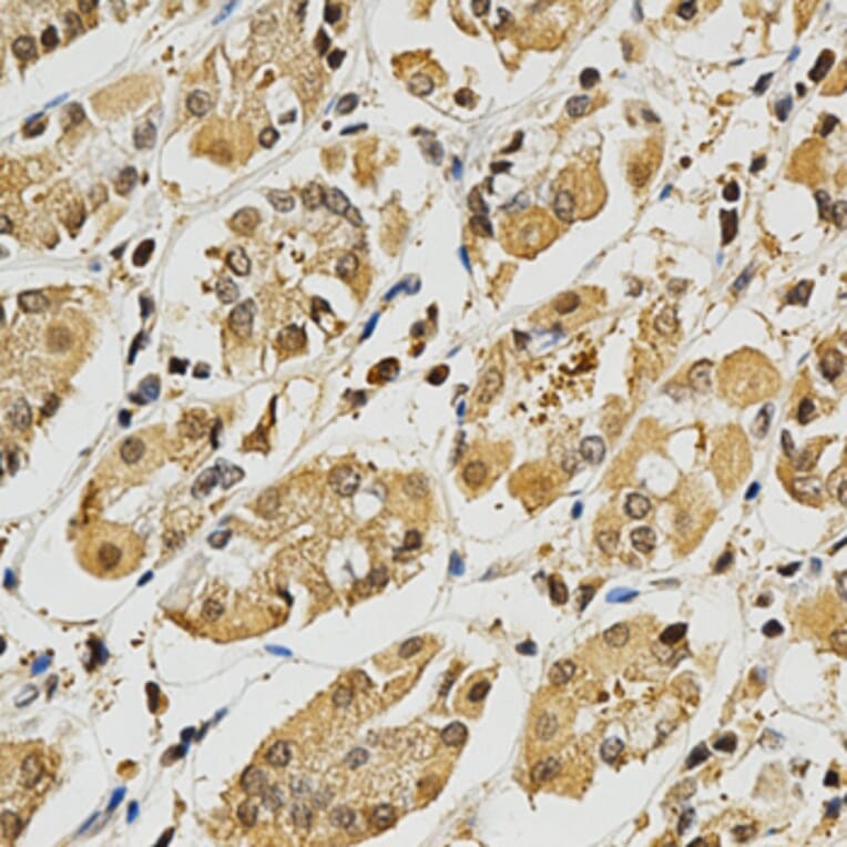 Immunohistochemistry - PLK1 Antibody from Signalway Antibody (32706) - Antibodies.com