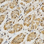 Immunohistochemistry - PLK1 Antibody from Signalway Antibody (32706) - Antibodies.com