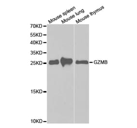 Western blot - GZMB Antibody from Signalway Antibody (32711) - Antibodies.com