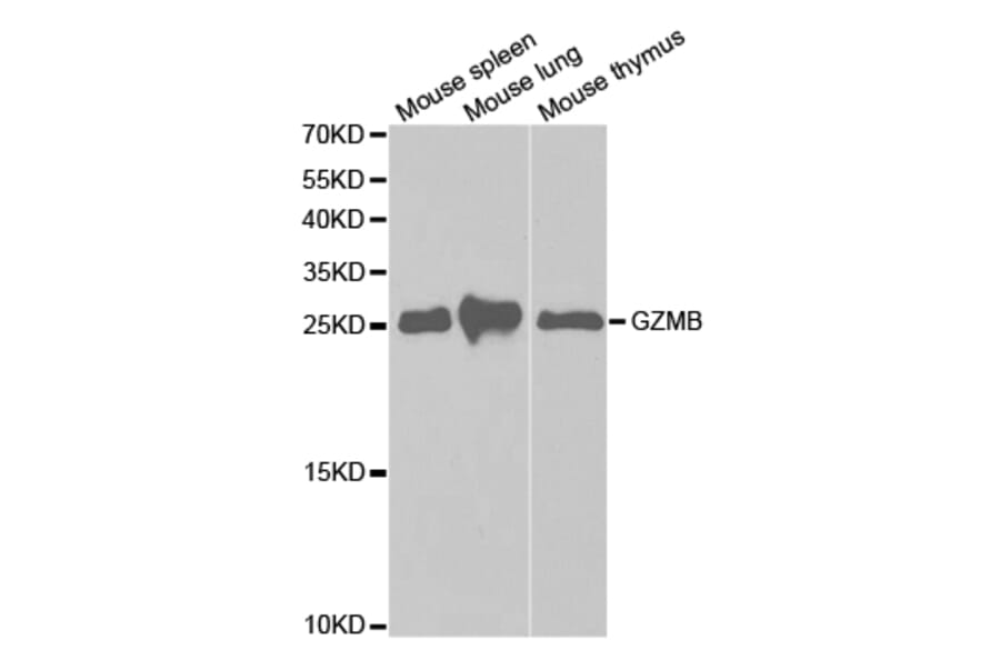 Western blot - GZMB Antibody from Signalway Antibody (32711) - Antibodies.com