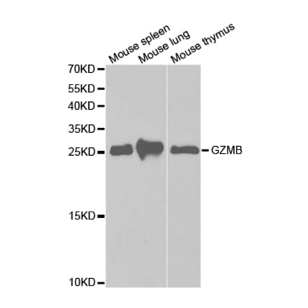 Western blot - GZMB Antibody from Signalway Antibody (32711) - Antibodies.com