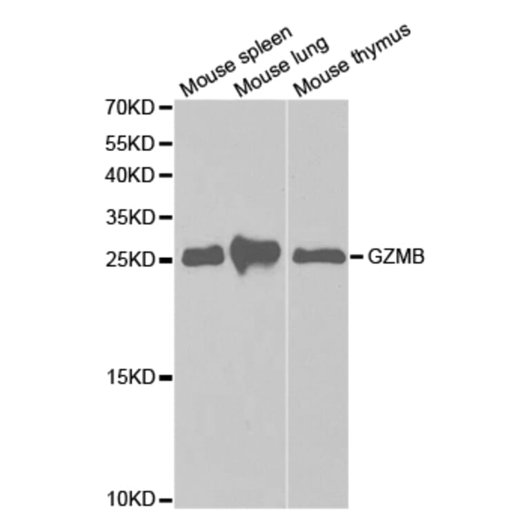 Western blot - GZMB Antibody from Signalway Antibody (32711) - Antibodies.com