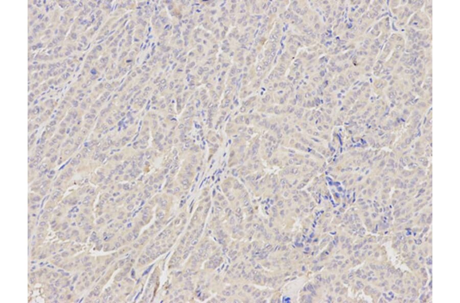 Immunohistochemistry - GZMB Antibody from Signalway Antibody (32711) - Antibodies.com