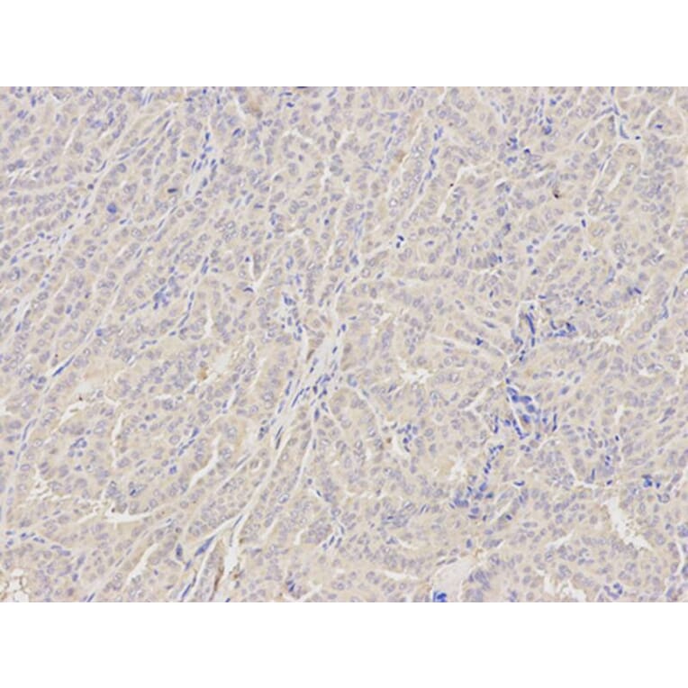 Immunohistochemistry - GZMB Antibody from Signalway Antibody (32711) - Antibodies.com